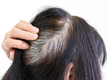 Greying of Hair treatment in Jalandhar