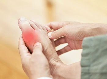 Gout treatment in homeopathy