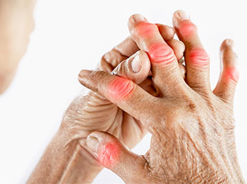 Rheumatoid Arthritis treatment in Jalandhar