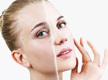 Blemishes treatment in homeopathy